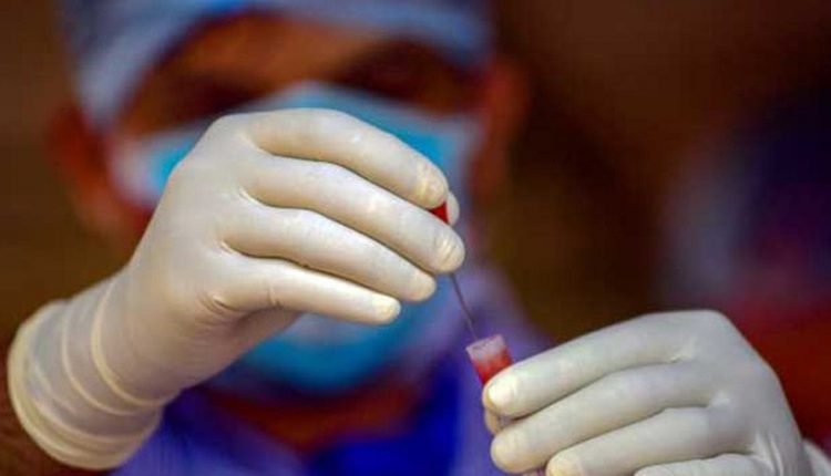 Telangana Covid-19 update: 2,256 new cases, 14 deaths