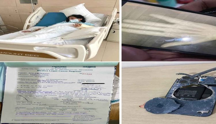 Domestic violence is not just confined lower-income groups