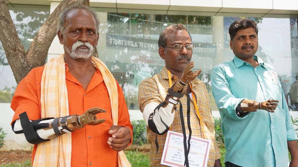 Prosthetic Hands Free Distribution Function organized at Malla Reddy University