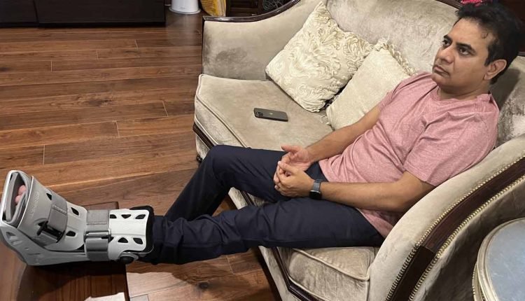 Minister KTR's leg injured on birthday, 3 weeks rest advised