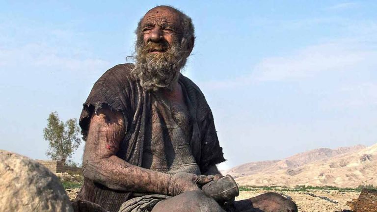 ‘World’s dirtiest man’ dies in Iran a few months after his first bath