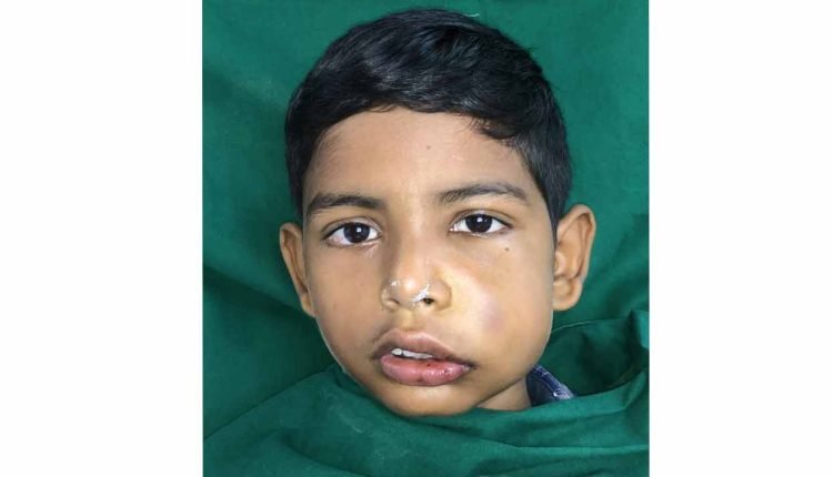 Turned away by hospitals, this 11-year-old saved his eyes with the support of GITAM doctors