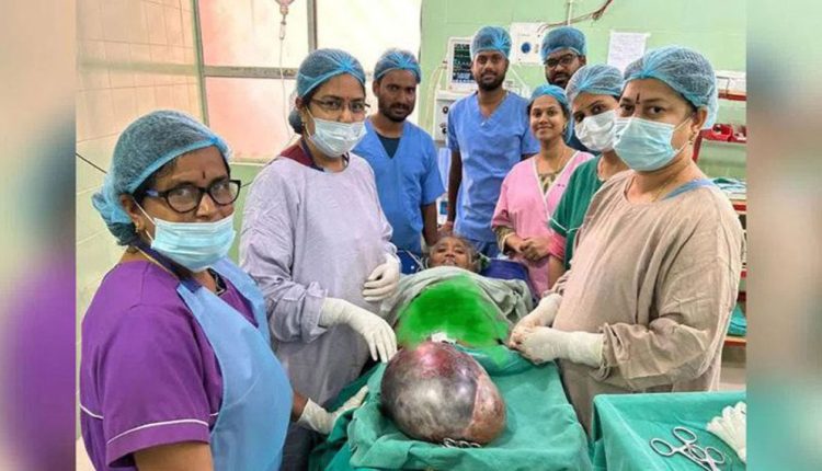 Kg Tumor Removed Successfully From Womans Stomach INDToday