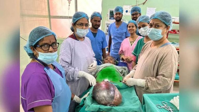 8 Kg Tumor Removed Successfully From Woman's Stomach