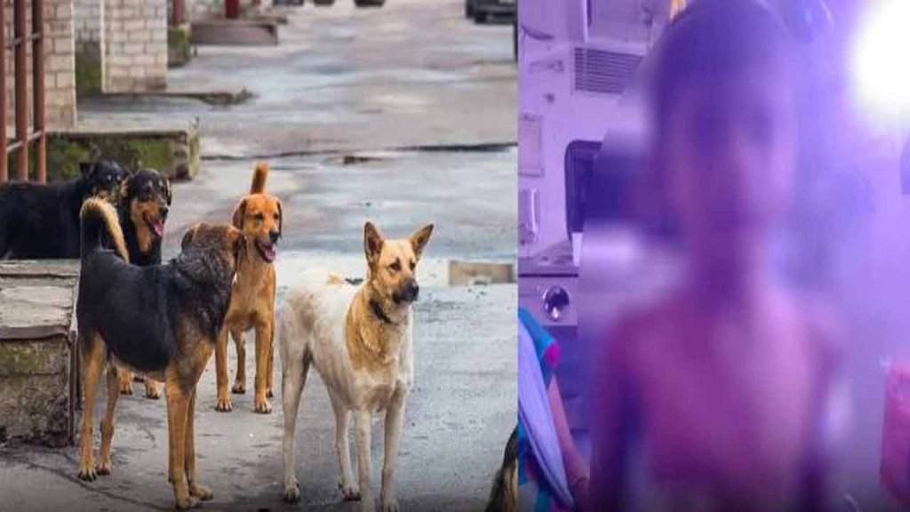 An Eight Year Old Boy Attacked By Stray Dogs