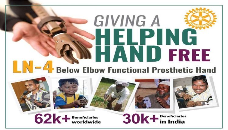 Free Artificial Imported Hands From USA Distribution Camp For The Poor People Who Lost Hands In Accidents And Are Unable To Buy Due to Financial Reasons