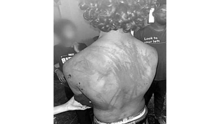 Employees Tortured in Hyderabad: 8 Held, More Still at Large