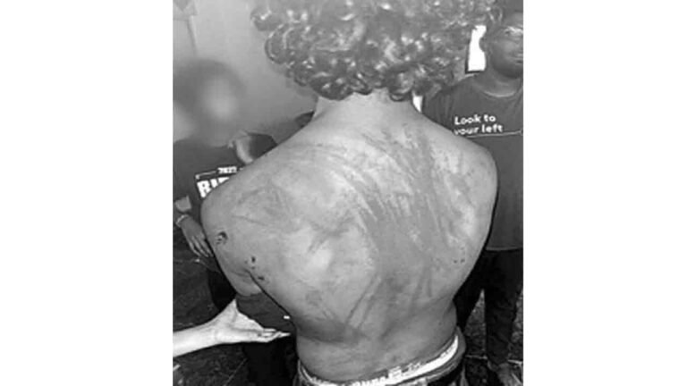 Employees Tortured in Hyderabad: 8 Held, More Still at Large
