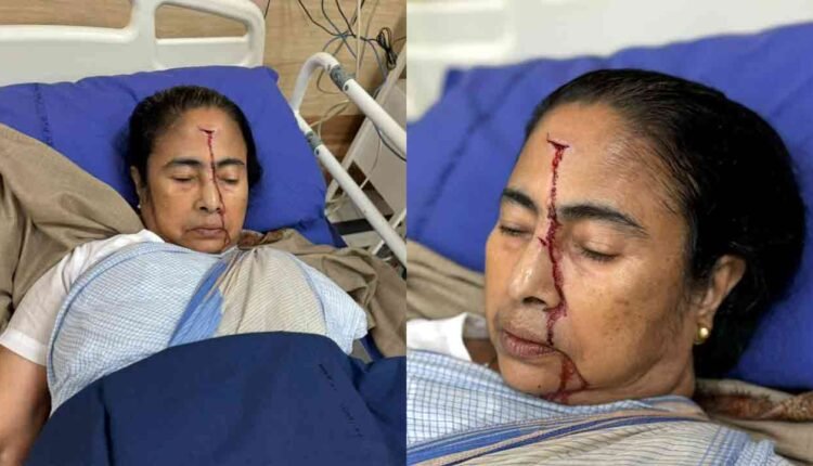 West Bengal CM Mamata Banerjee Sustains Major Injury, Admitted In Hospital