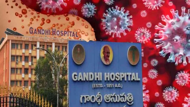 Monkeypox Spread: Hyderabad Hospitals On A High Alert