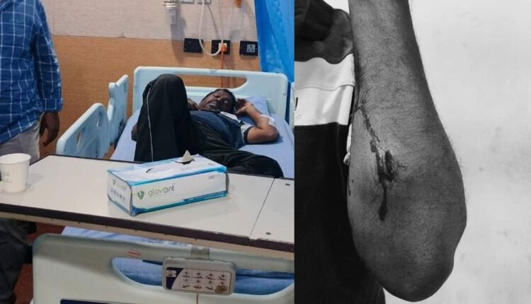 Hindu Lawyer Attacked Near IMAX Theatre In Hyderabad