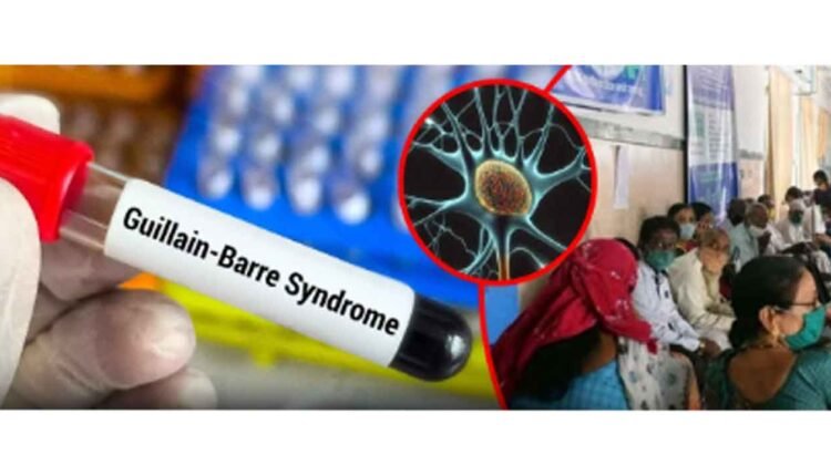 First Death Confirmed Of Guillain-Barré Syndrome Outbreak In Pune