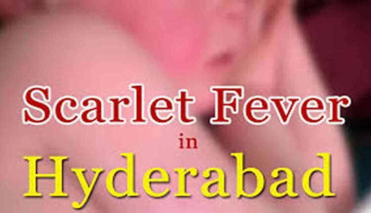 Scarlet Fever Cases On Rise In Hyderabad