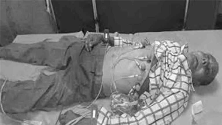 Man Dies of Heart Attack in Fish Prasadam Queue