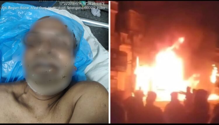 Shah Ali Banda Fire: Shop Owner Critically Injured, One Dead