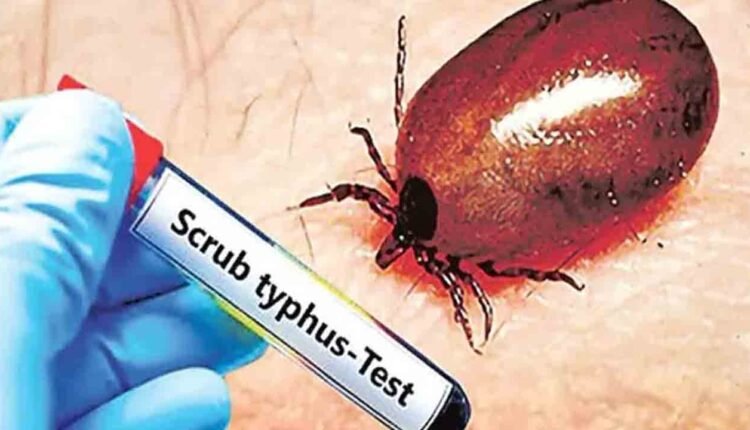Scrub Typhus Cases Rise In Andhra Pradesh, 1,806 Positive