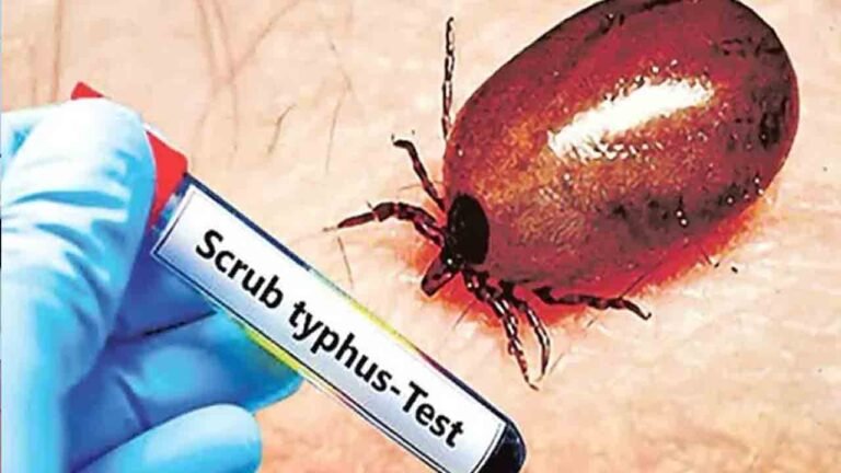 Scrub Typhus Cases Rise In Andhra Pradesh, 1,806 Positive
