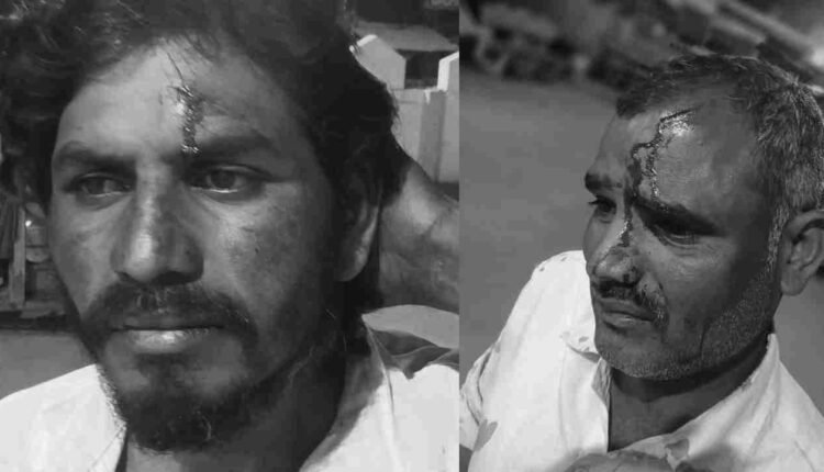 BRS Workers Injured In Attack By Congress Leaders