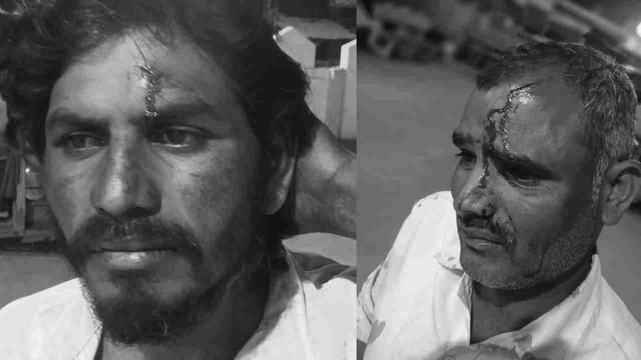 BRS Workers Injured In Attack By Congress Leaders