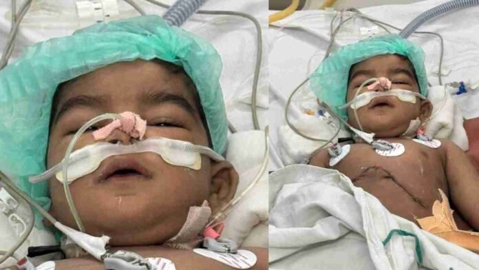 Rare Liver Transplant at Osmania Saves Infant in Hyderabad