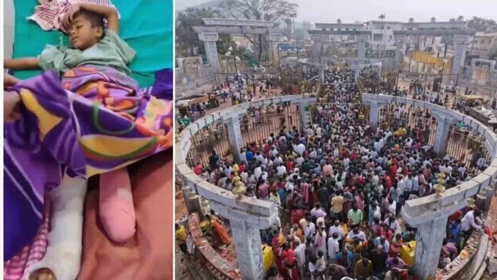 Medaram Accident Boy Leg Amputated After Collapse