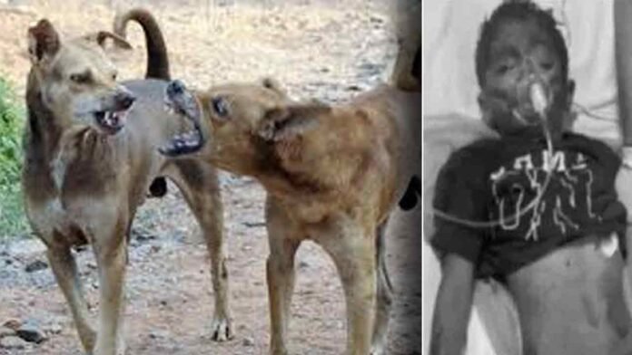 10 Street Dogs Attacked A Boy In Hyderabad