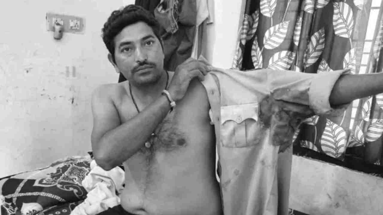 Constable Attacked With Knife While Trying To Prevent A Fight Between Husband And Wife